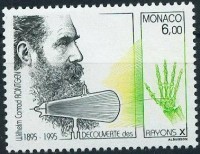 Timbre representant la découverte des rayons X.